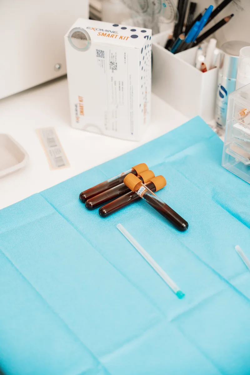 Blood sample tubes prepared for private biomarker testing at CellOrtho Marbella