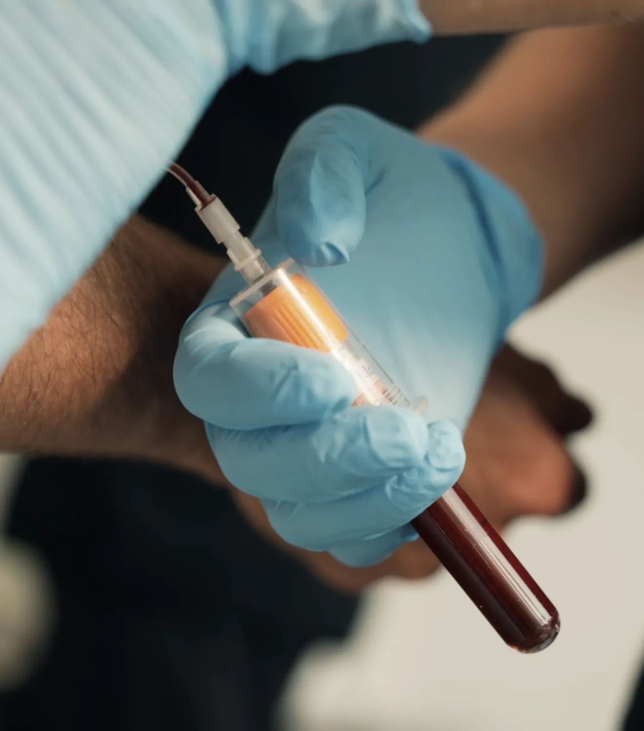 Orthobiologic treatment